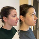 ORSI FaceSculpt® – Ritual de Drenagem Facial Premium