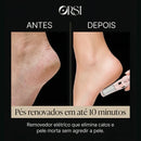 Orsi SensiSole – Lixa Elétrica Ultra Suave para Pés